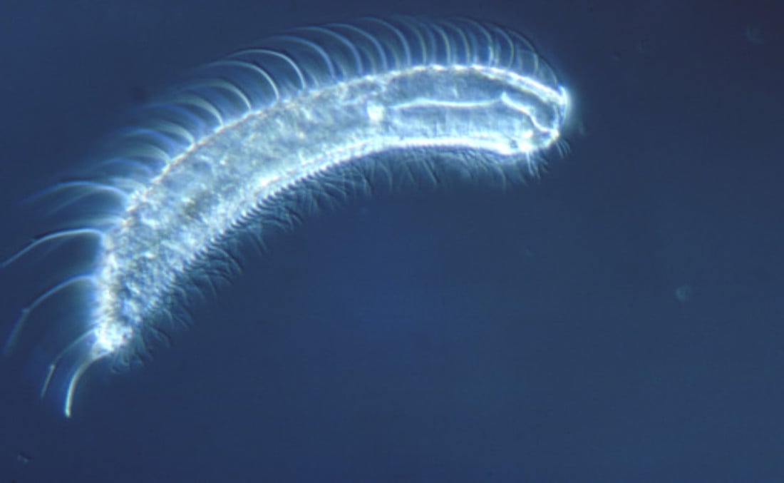 100634-gastrotrich.jpg