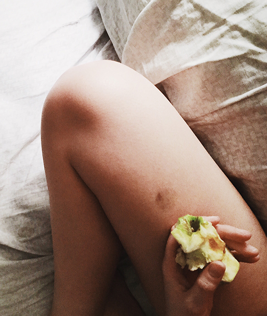 128766-8-bruise.jpg