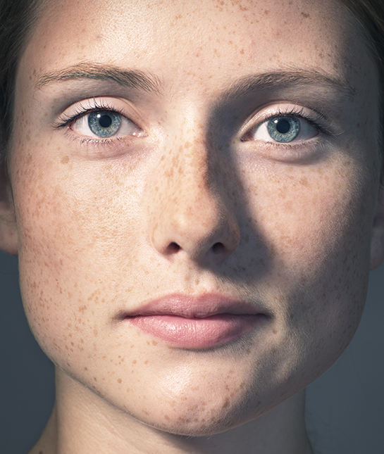 Young woman's portrait with freckles