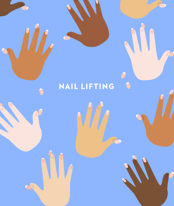 153041-moms_weirdpregsymptoms_v01_ac_nail-lifting.png