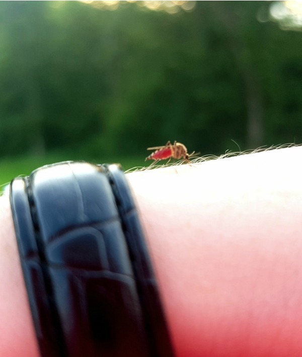 170590-bug-bite.jpg