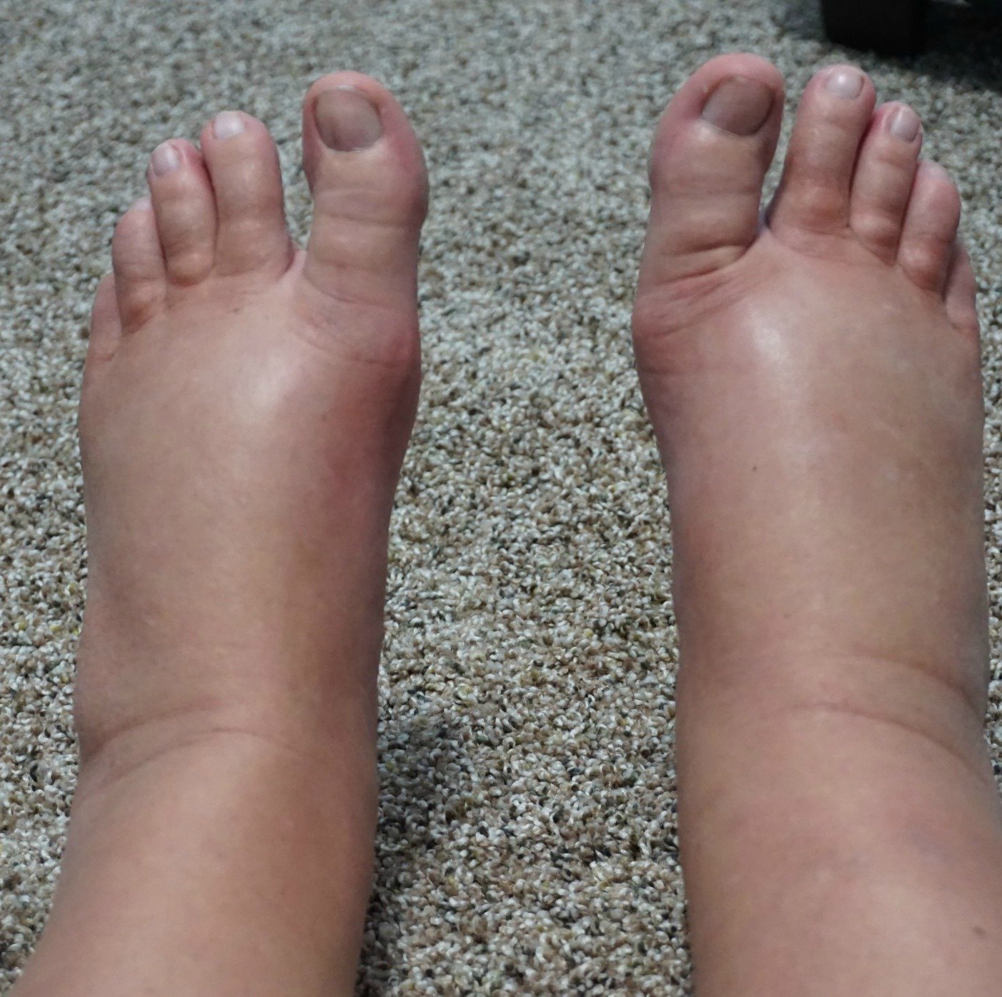 171712-feet.jpg