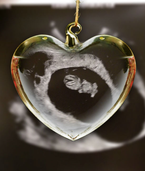 187583-sonogram-ornament.jpg
