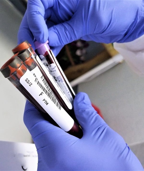 196630-anemia.jpg