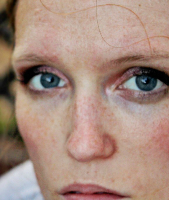 198535-signs-serious-health-problems-anxiety.jpg