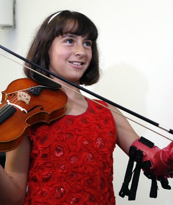 Girl Violin Prosthetic, Fairfax, USA - 20 Apr 2017 Girl Violin Prosthetic, Fairfax, USA - 20 Apr 2017