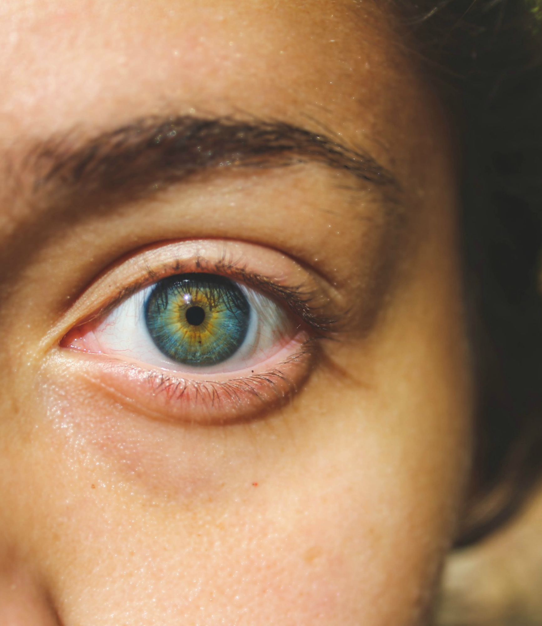 218204-what-happened-me-eight-glasses-water-undereye-circles.jpg