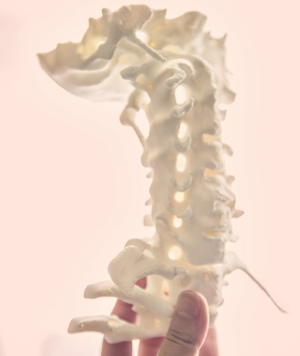 227048-low-bone-density.jpg