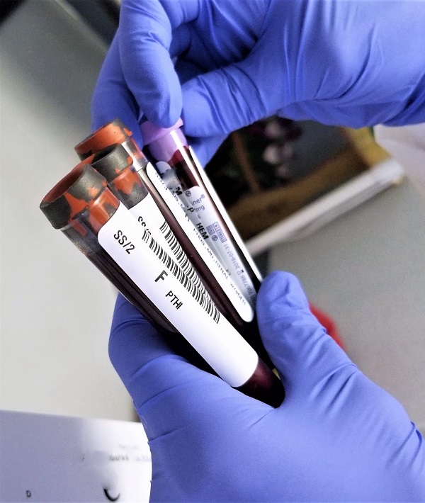 227059-bloodstream.jpg
