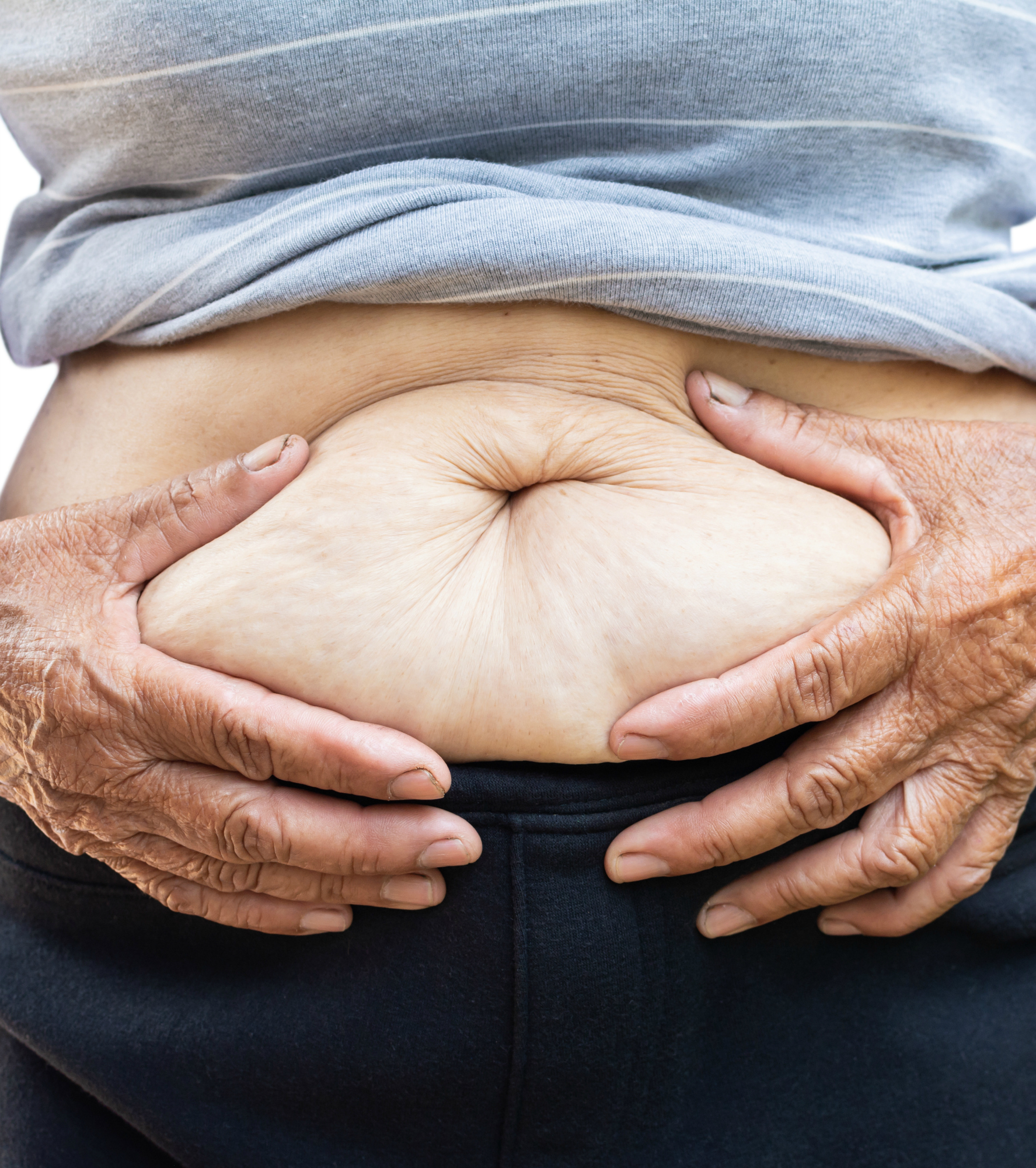 Close up female abdominal surface , Fat and health care concept.