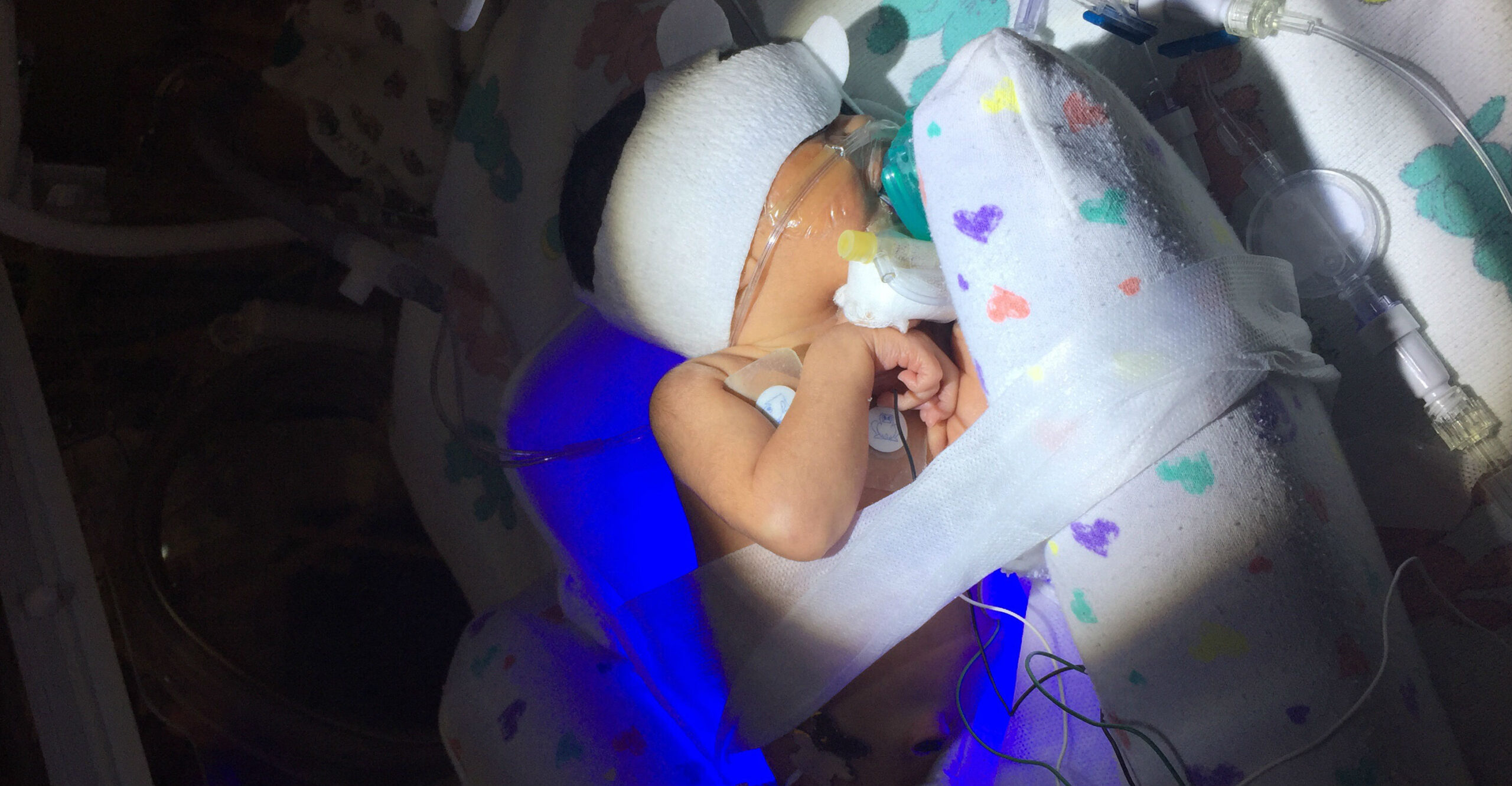 baby-in-the-nicu_t20_rwkgxk