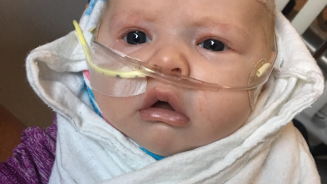 rsv-baby