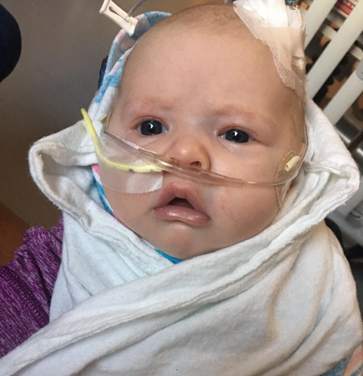 rsv-baby