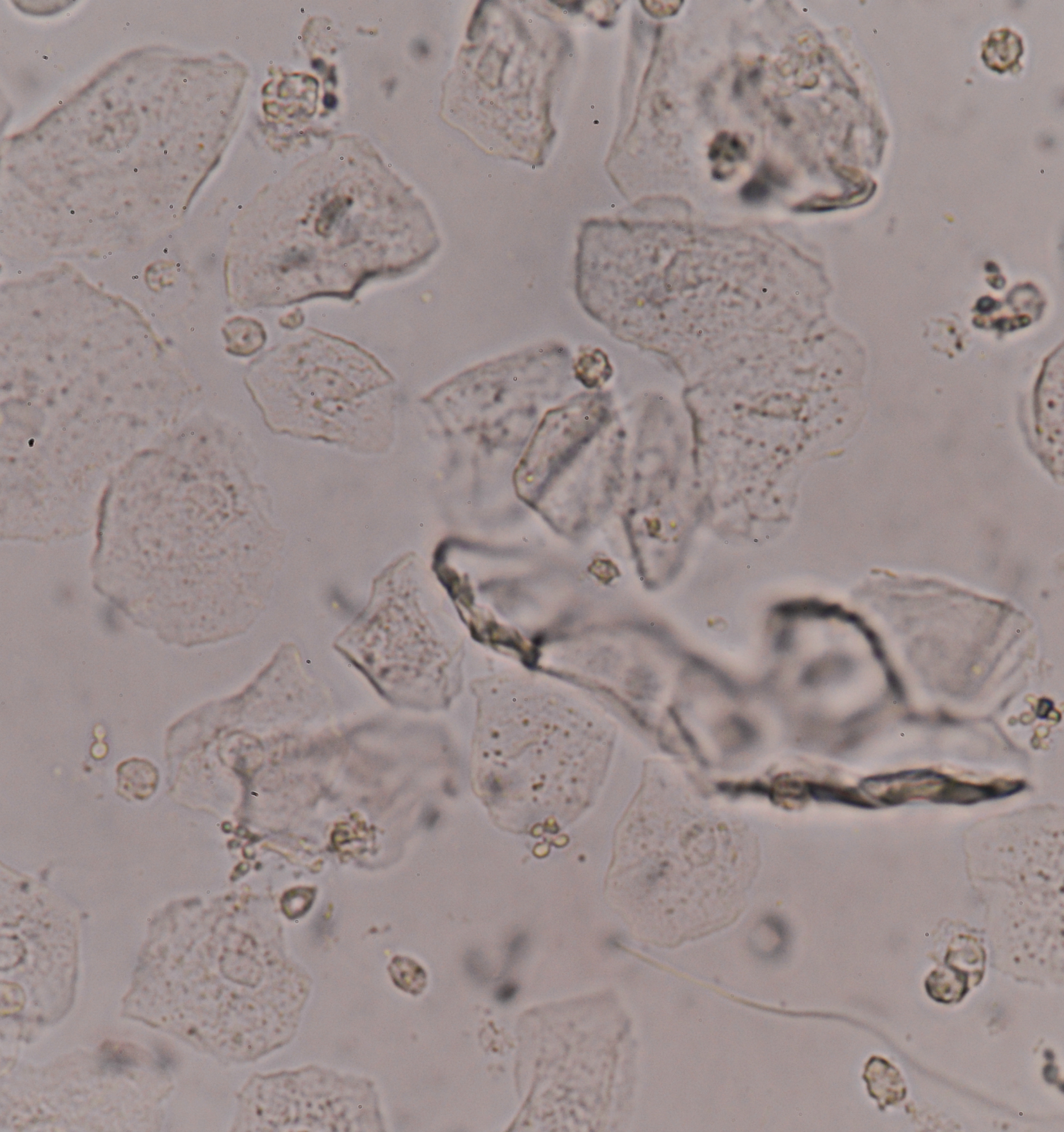 248807-health-problems-tongue-hpv.jpg