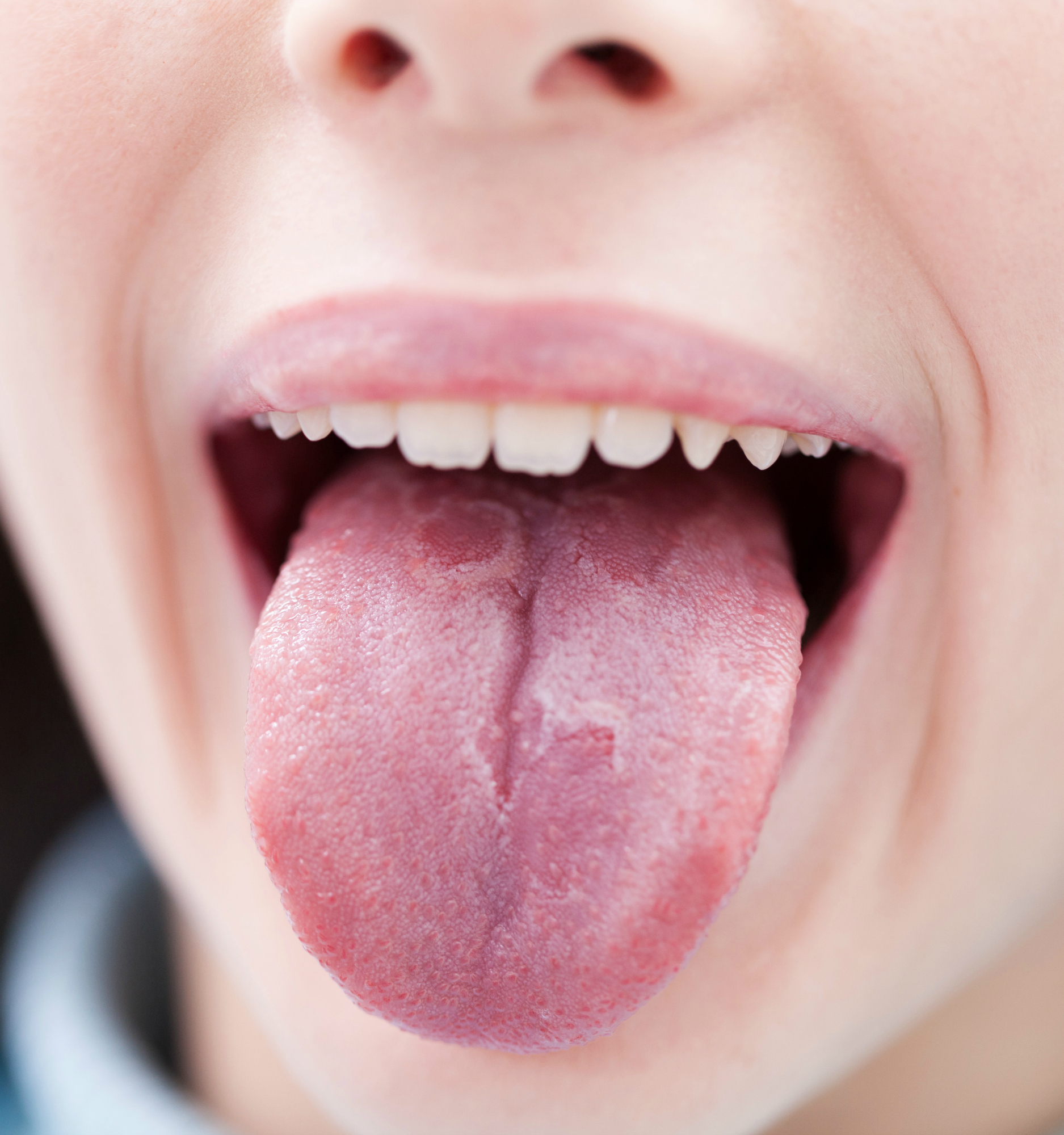 248817-health-problems-tongue-cancer.jpg
