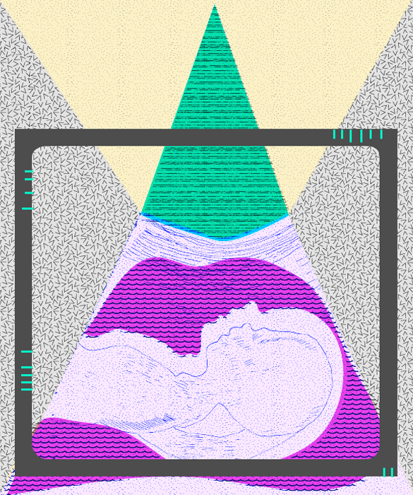 29336-3-ultrasound-images.png