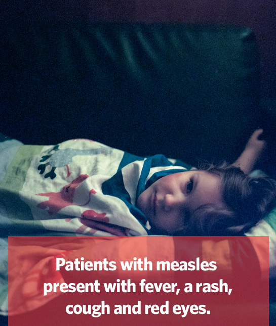 94313-measles-4.jpg