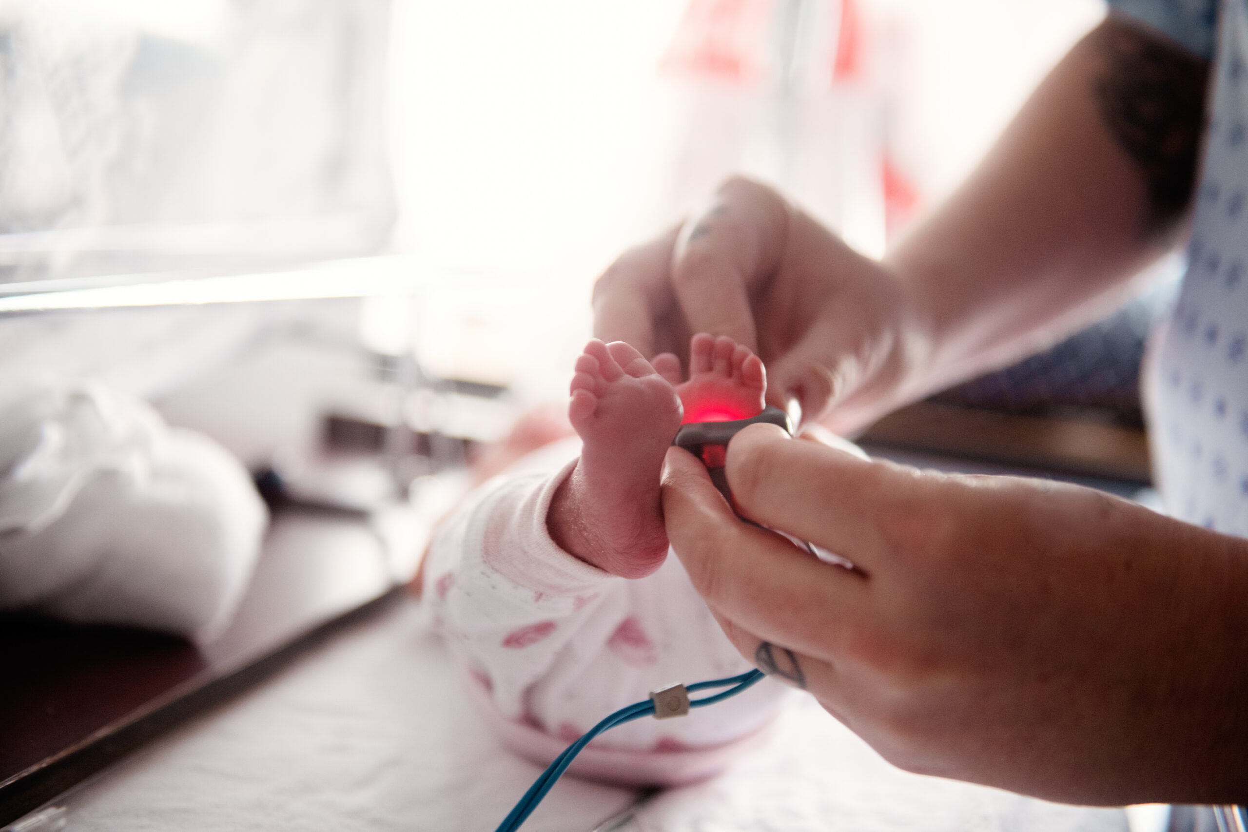 Premature baby girl feet plugging in to oxygen machine.