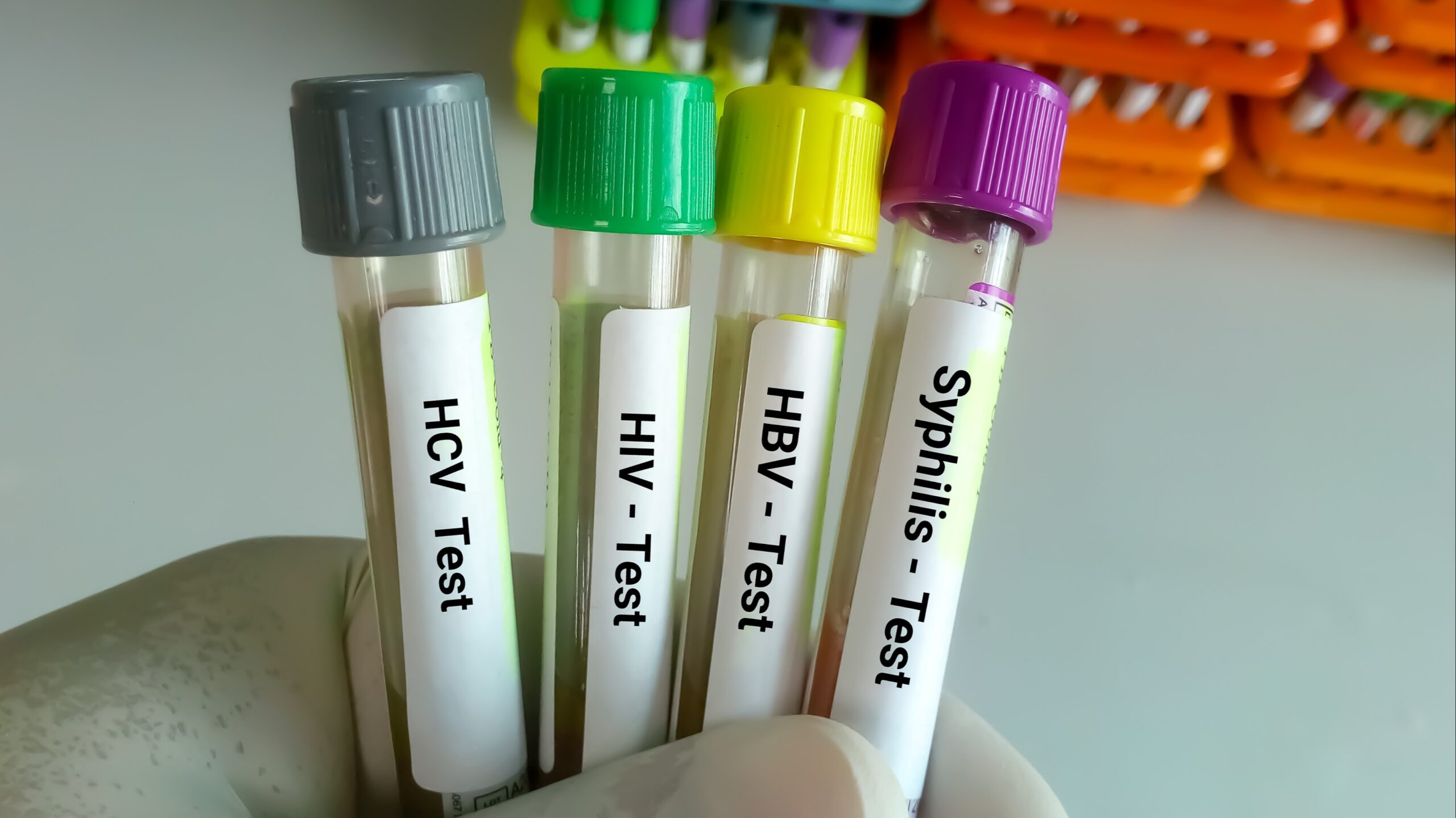 STD Testing
