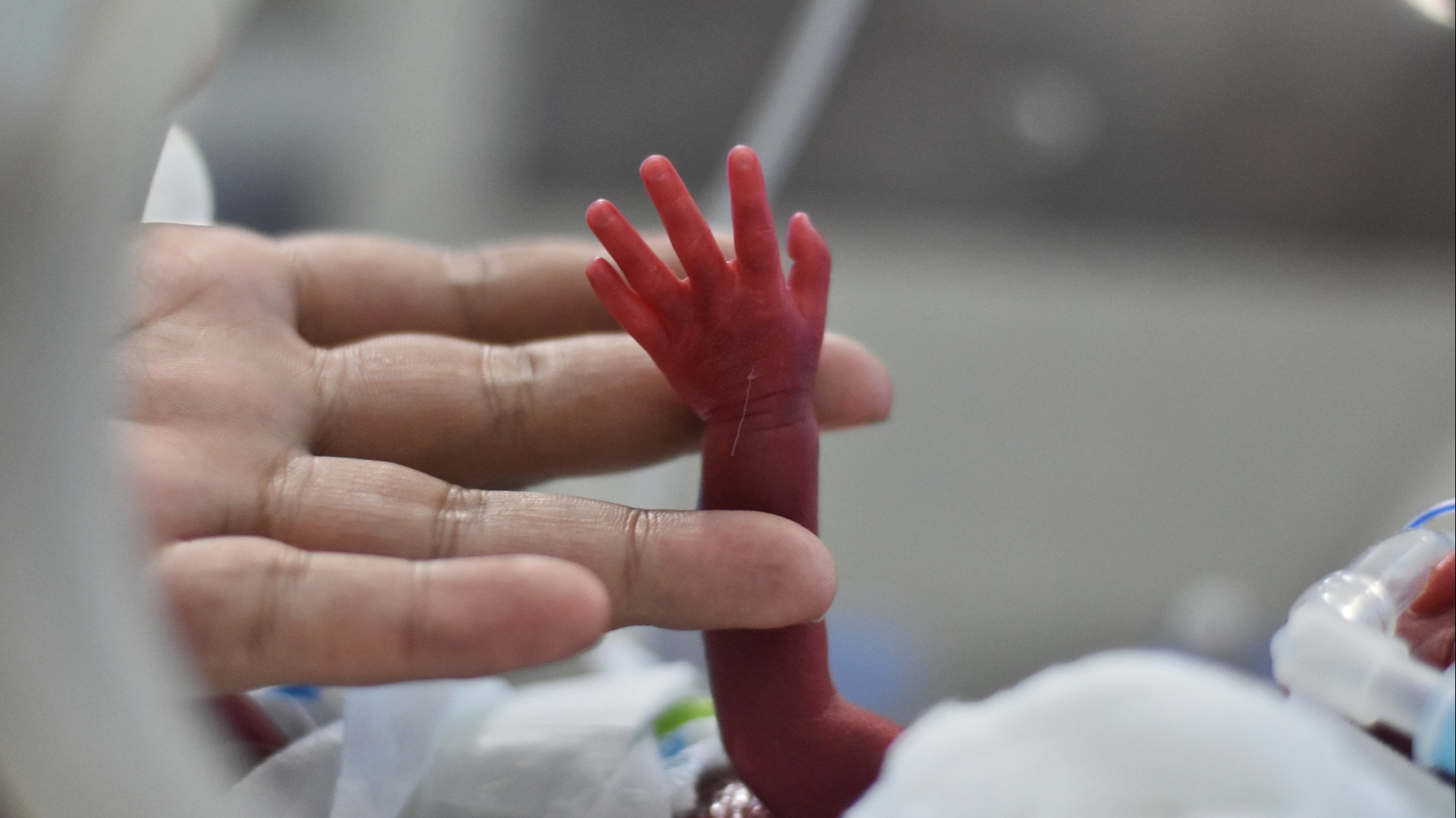 A newborn in the NICU