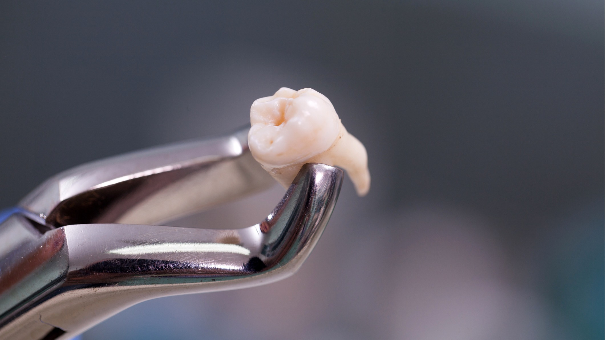 A tooth