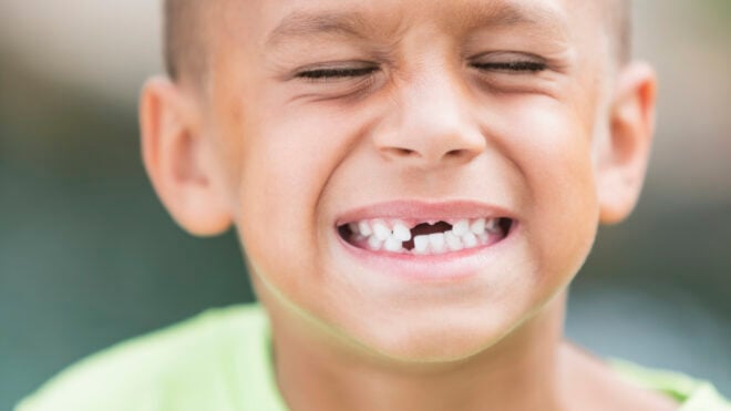 little-boy-missing-teeth