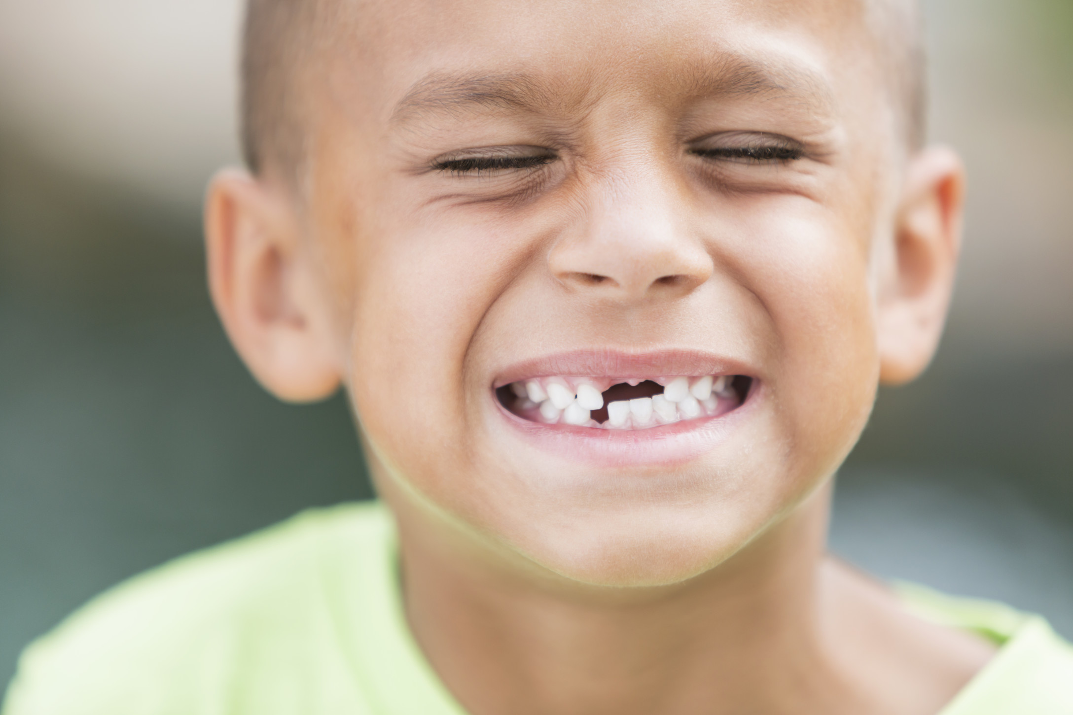 little-boy-missing-teeth