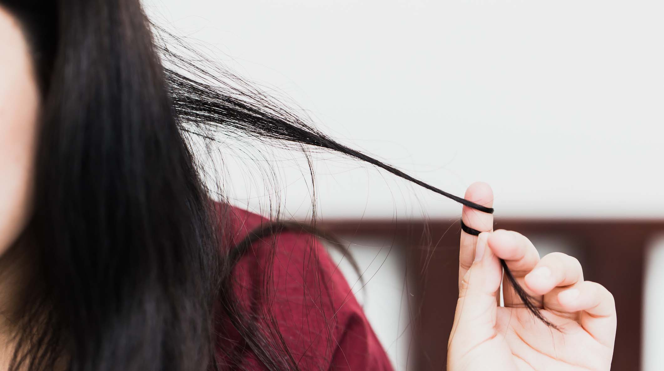 Trichotillomania or hair pulling disorder in mental health problem with stress or worry women