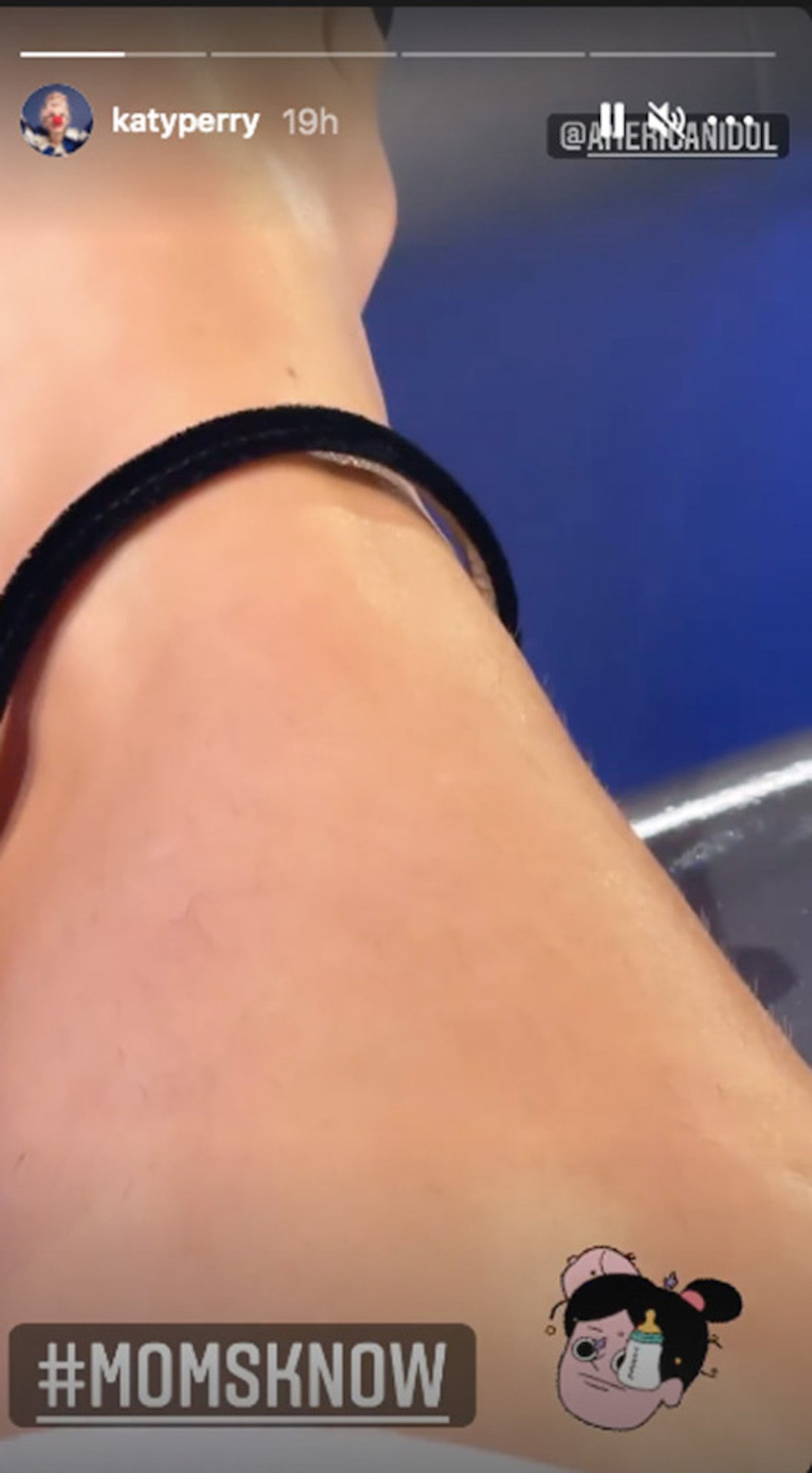 katy-perry-unshaved-leg.jpeg