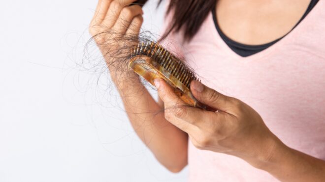 post partum hair loss