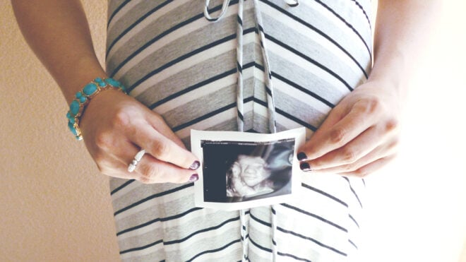 3d-ultrasound-featured