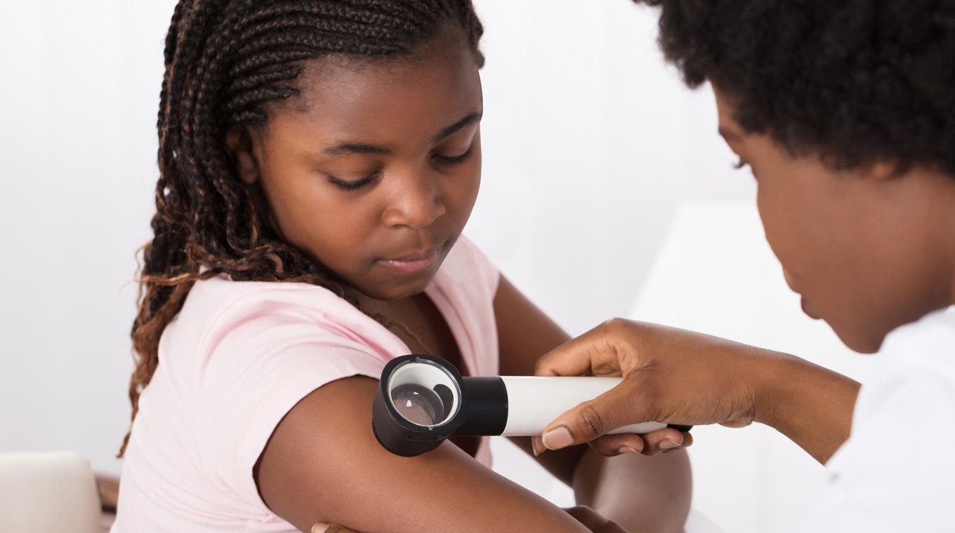 my-child-got-a-tick-bite-3
