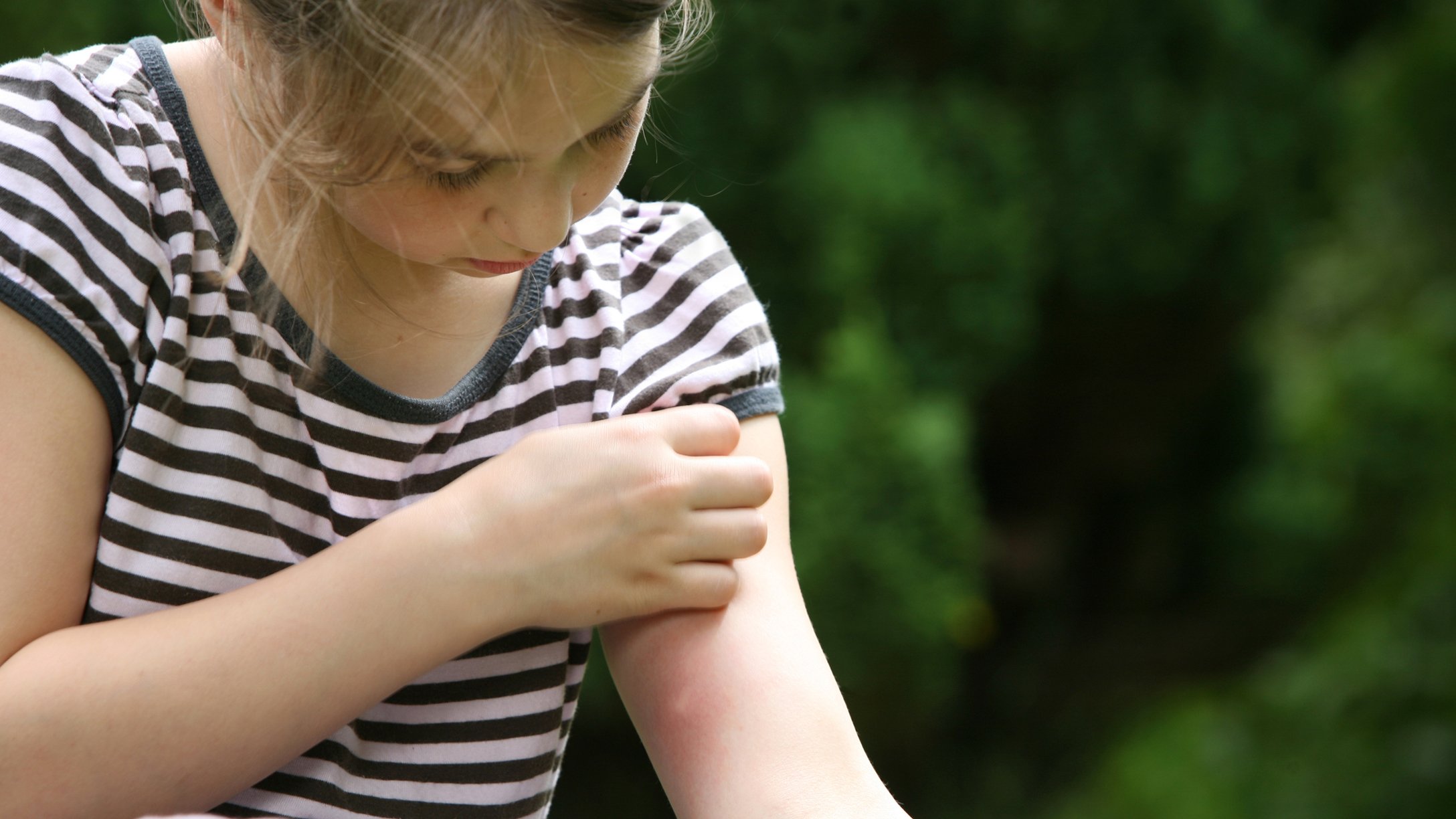 my-child-got-a-tick-bite-featured