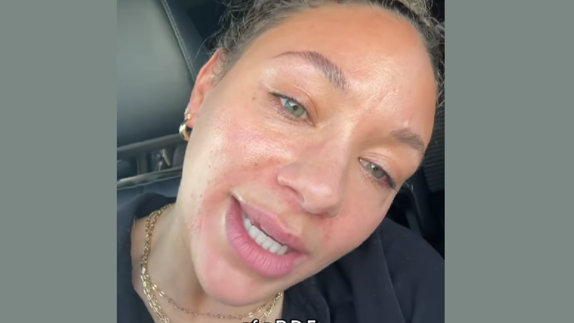 Influencer afirma que la cultura delgada de hoy en día tiene raíces mucho más oscuras.